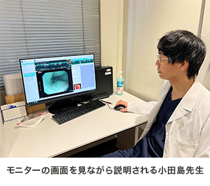 経口・径鼻内視鏡の太さ比較